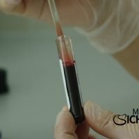 Test auf Geschlechtskrankheiten